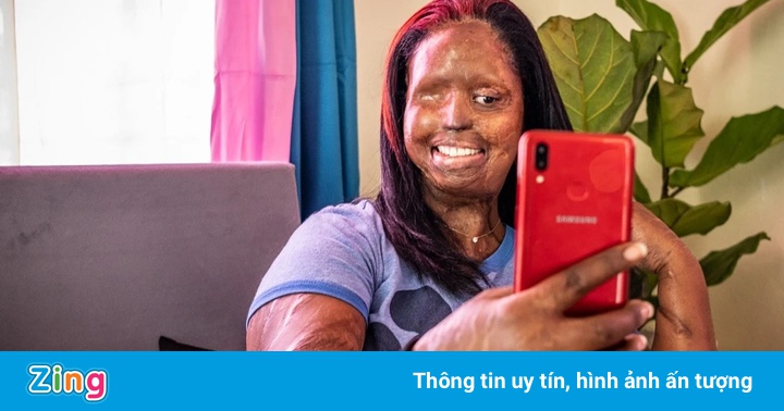 Tấm ảnh selfie lấy lại tiếng nói cho những nạn nhân bị tạt axit