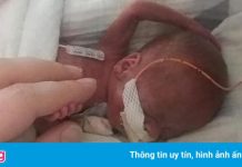 Em bé sinh non nhất thế giới đón sinh nhật đầu tiên