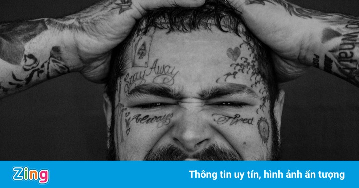 Rapper đính kim cương giá 1,6 triệu USD lên răng