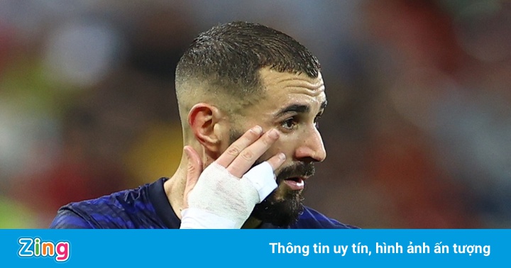 Sự trở lại của Benzema khiến tuyển Pháp phải trả giá Sự trở lại của Benzema khiến tuyển Pháp phải trả giá