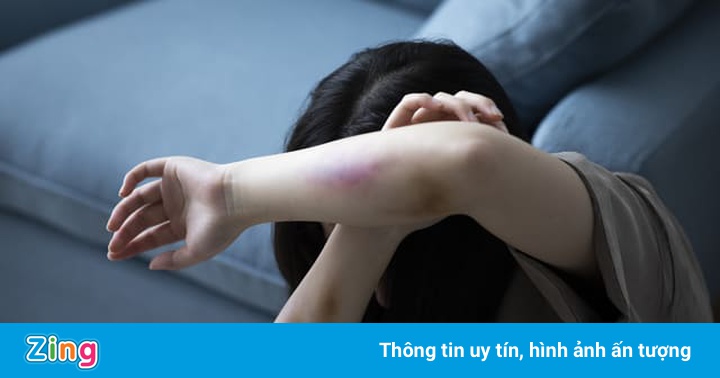 Bố đánh con vì làm bài thi vào lớp 10 không tốt, xử lý thế nào?