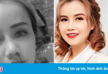 Bi kịch bị chồng bạo hành của nhiều sao Việt