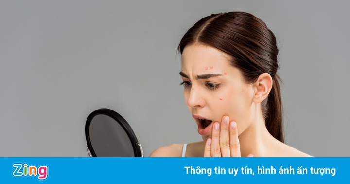 Những lưu ý khi lựa chọn sản phẩm bổ sung collagen