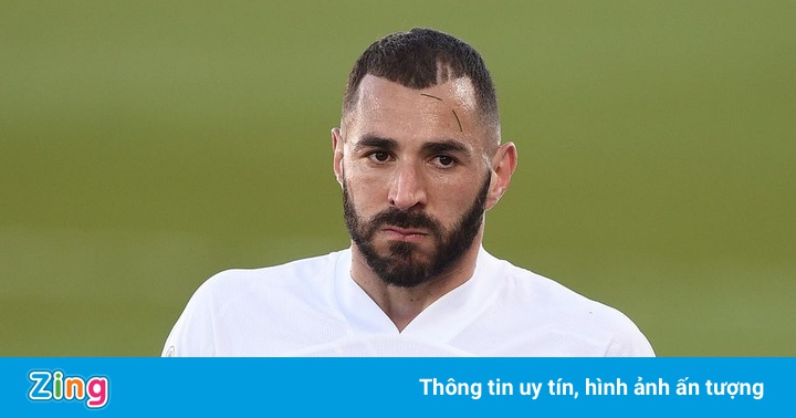 Benzema dương tính với Covid-19