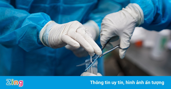 Thêm 80 bệnh nhân Covid-19 tử vong trong 10 ngày