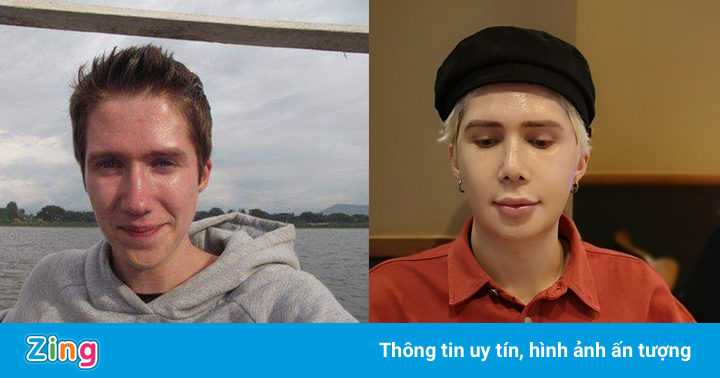 Chàng trai Anh nhận là người Hàn, phẫu thuật 18 lần để giống idol Chàng trai Anh nhận là người Hàn, phẫu thuật 18 lần để giống idol