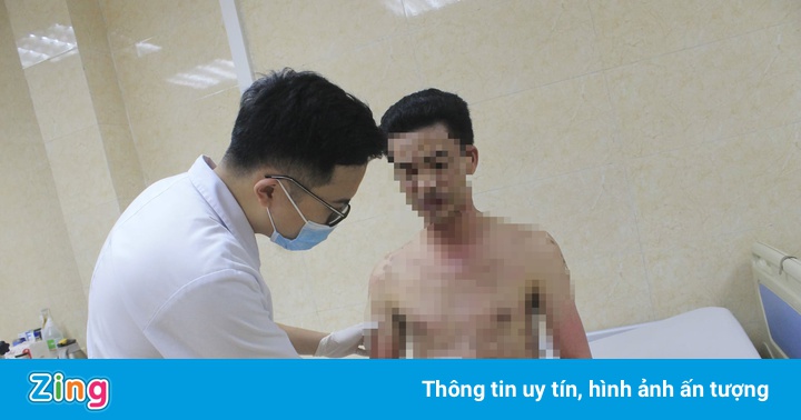 Người đàn ông bị loét toàn thân vì dị ứng thuốc