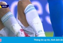 Chân rớm máu của sao Argentina