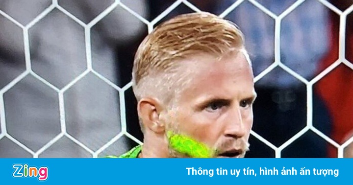 UEFA sẽ xử lý vụ Schmeichel bị chiếu laser