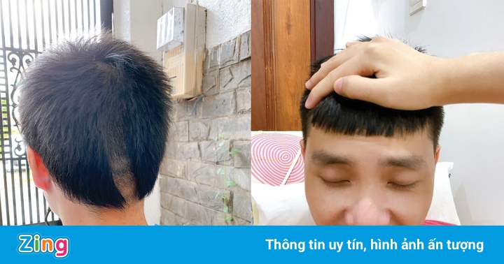 Người trẻ ở TP.HCM kể chuyện ‘tự xử’ tóc tai mùa dịch