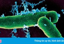 Dịch bệnh than nghi bùng phát tại ngôi làng ở Trung Quốc