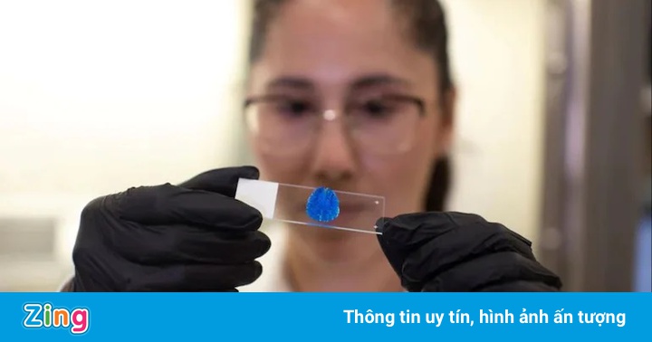 Israel in thành công khối ung thư não 3D đầu tiên trên thế giới Israel in thành công khối ung thư não 3D đầu tiên trên thế giới
