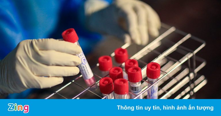 Lấy 1,6 triệu test nhanh, TP.HCM phát hiện 64.300 mẫu dương tính Lấy 1,6 triệu test nhanh, TP.HCM phát hiện 64.300 mẫu dương tính
