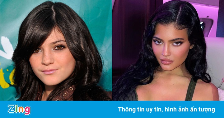 Sự thay đổi của Kylie Jenner ở tuổi 24