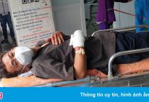 Lái xe chém lìa bàn tay người dân đối diện mức án nào?