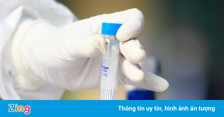 Hà Nội chuẩn bị xét nghiệm cho 300.000 người nguy cơ cao Hà Nội chuẩn bị xét nghiệm cho 300.000 người nguy cơ cao
