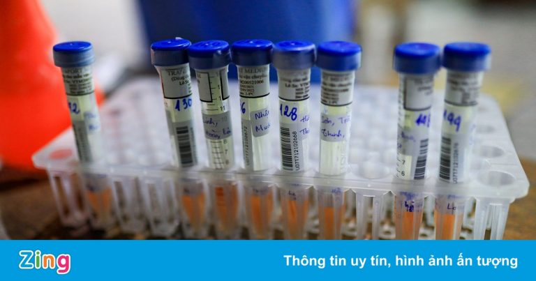 TP.HCM lấy gần 950.000 mẫu test nhanh, hơn 32.000 mẫu dương tính