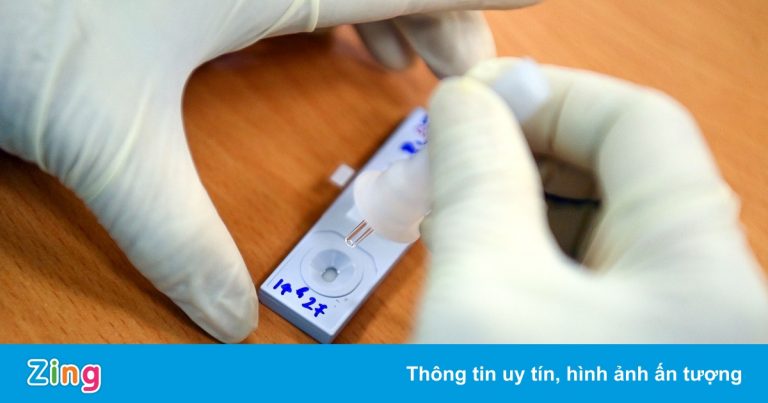 Lấy 1,4 triệu test nhanh, TP.HCM phát hiện hơn 54.000 mẫu dương tính Lấy 1,4 triệu test nhanh, TP.HCM phát hiện hơn 54.000 mẫu dương tính