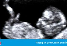 Trung Quốc hạn chế việc phá thai không vì mục đích y tế