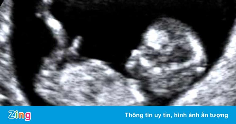 Trung Quốc hạn chế việc phá thai không vì mục đích y tế