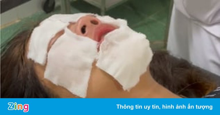 Xịt hơi cay vào mặt nữ sinh, nam thanh niên phạm tội gì?