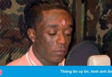 Khán giả giật viên kim cương 24 triệu USD rơi khỏi trán rapper Mỹ