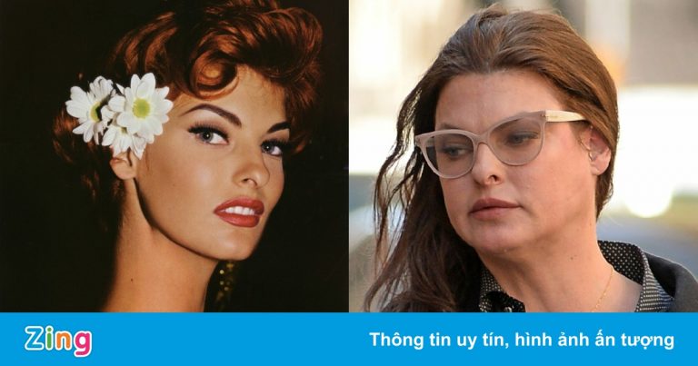 Siêu mẫu Linda Evangelista bị biến dạng cơ thể vì làm đẹp