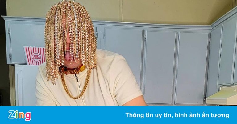 Nam rapper cấy dây chuyền vàng vào da đầu