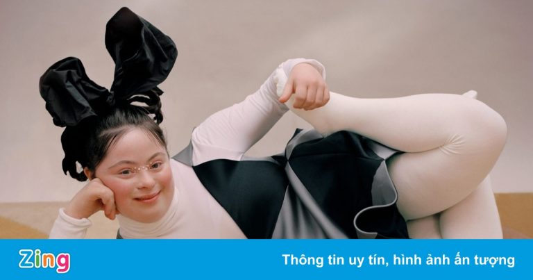 Sau mẫu ngoại cỡ, người khuyết tật đổ bộ giới thời trang Sau mẫu ngoại cỡ, người khuyết tật đổ bộ giới thời trang