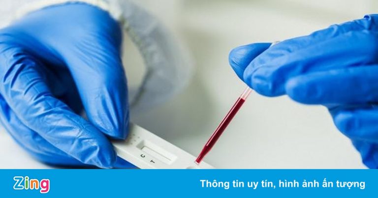 Tôi có nên test kháng thể sau tiêm vaccine Covid-19?