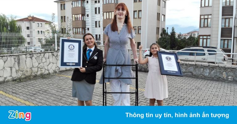 Căn bệnh khiến cô gái Tây Ban Nha cao hơn 2 m