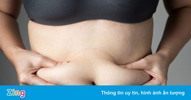 7 nguyên nhân dễ gây béo bụng