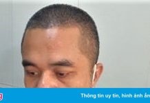 Hé lộ nguyên nhân vụ giám đốc công ty bất động sản bị bắn