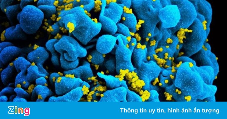 Phương pháp chữa HIV đột phá sắp được thử nghiệm trên người