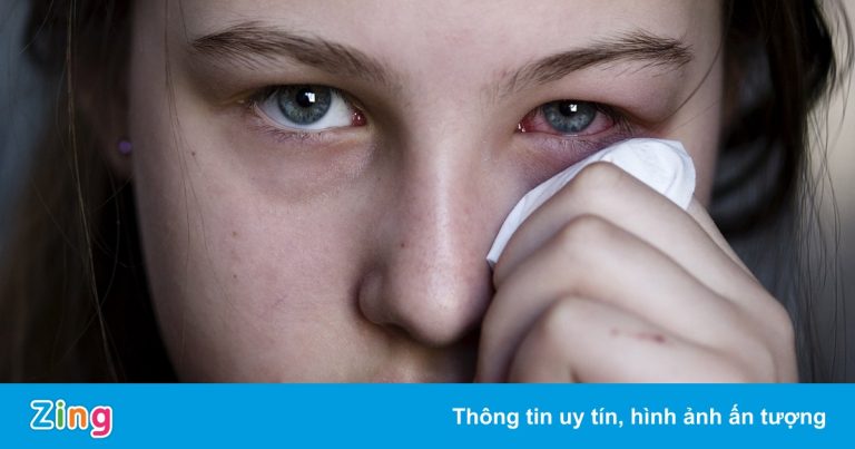 Triệu chứng dễ nhầm lẫn giữa Covid-19 và dị ứng