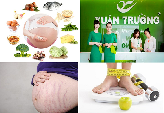 Vượt qua ám ảnh rạn da bụng sau sinh cùng với Thẩm mỹ Xuân Trường