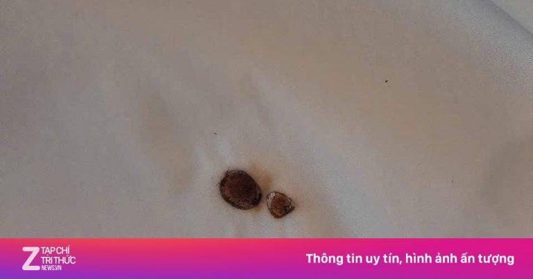 Khách hút thuốc cháy đệm, khách sạn Cửa Lò yêu cầu đền 4,8 triệu đồng Khách hút thuốc cháy đệm, khách sạn Cửa Lò yêu cầu đền 4,8 triệu đồng