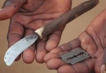 Hủ tục cắt bao quy đầu trong nghi lễ trưởng thành khiến 39 người chết